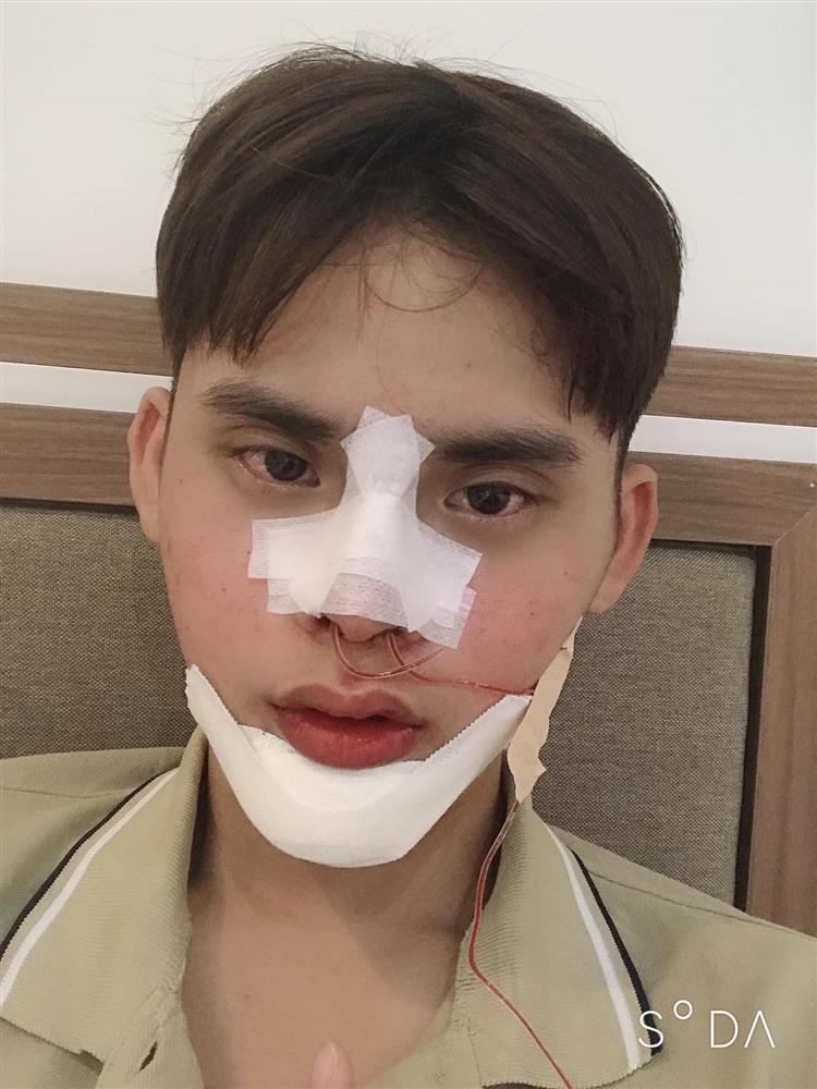 Thốn tận rốn pha gọt hàm của chàng trai, kết quả gây bất ngờ-4