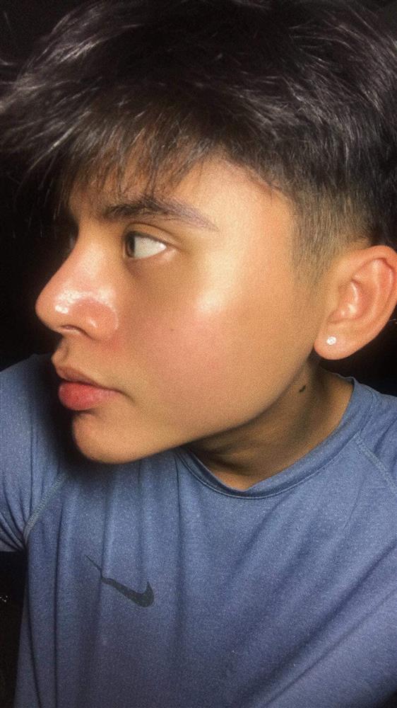 Thốn tận rốn pha gọt hàm của chàng trai, kết quả gây bất ngờ-6