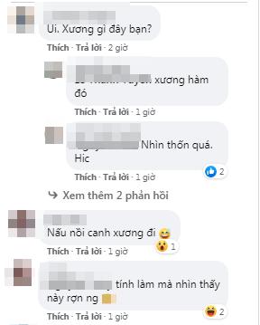 Thốn tận rốn pha gọt hàm của chàng trai, kết quả gây bất ngờ-8