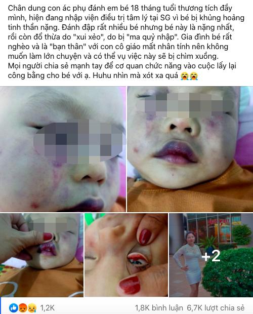 Cô giáo đánh bé 18 tháng tuổi thương tích, nhập viện vì quá hoảng sợ?-1