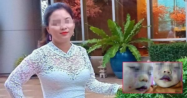 Cô giáo phủ nhận việc đánh trẻ 18 tháng nhập viện-2