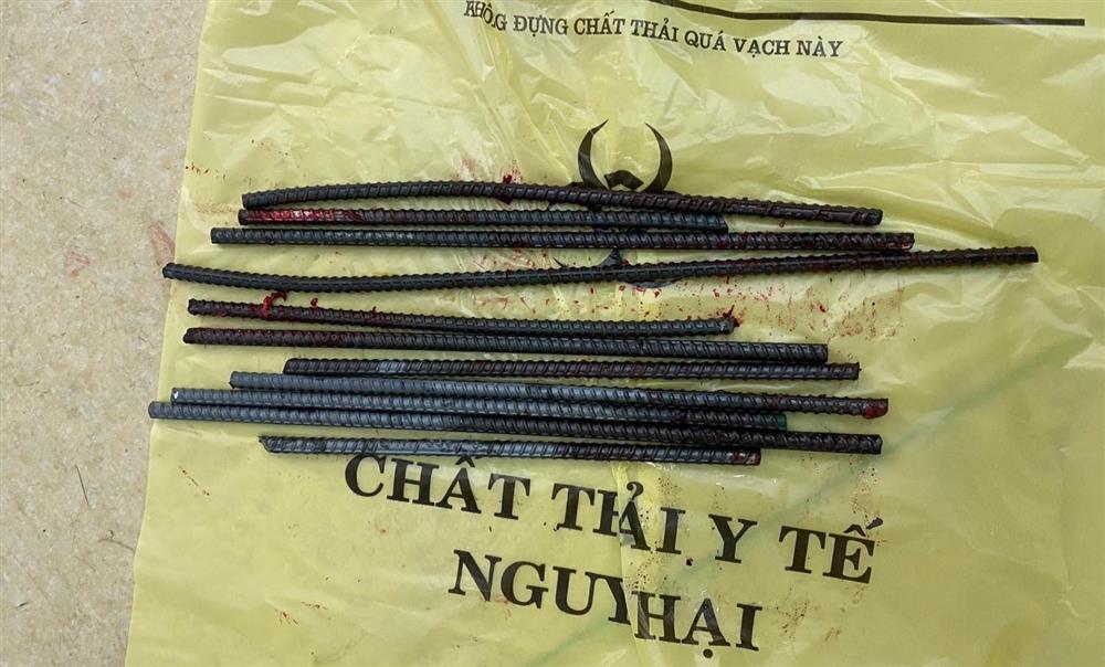 Kinh hoàng: Thanh niên bị 11 thanh sắt từ xe ba gác đâm xuyên chân-4