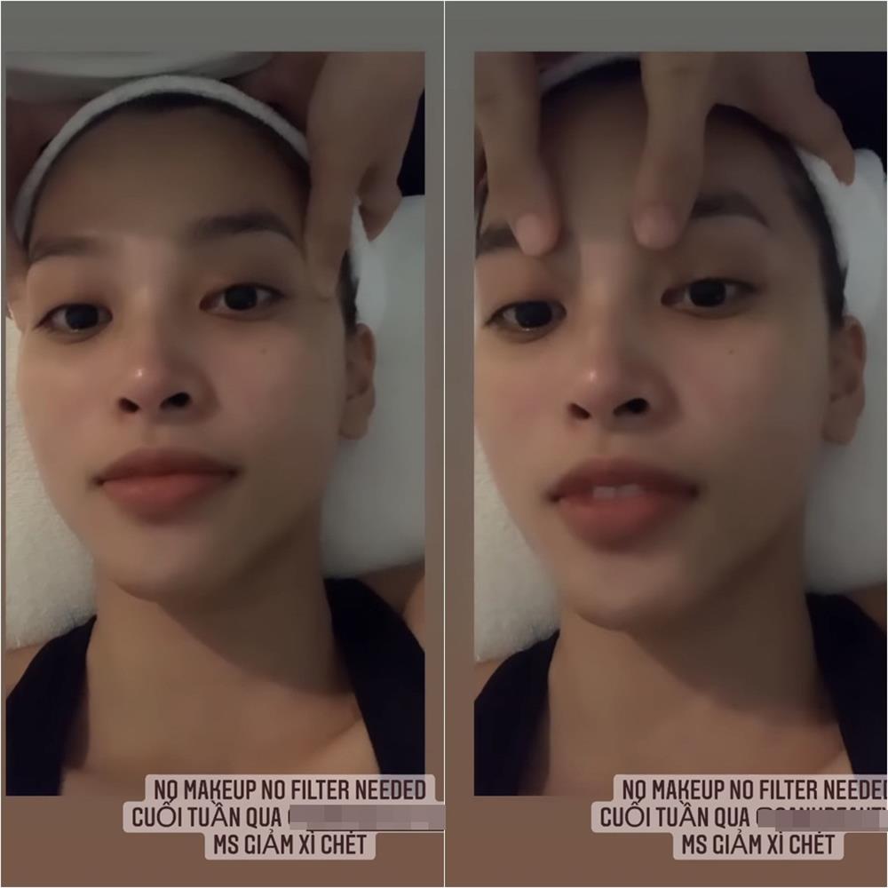 Tiểu Vy căng da không cần dao kéo nhờ liệu pháp massage-1