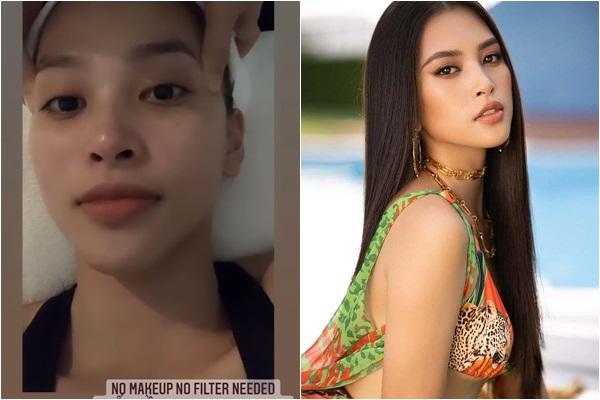 Từ A-Z về cấy chỉ căng da mặt - phương pháp trẻ hóa dung nhan đang hot rần rần-8