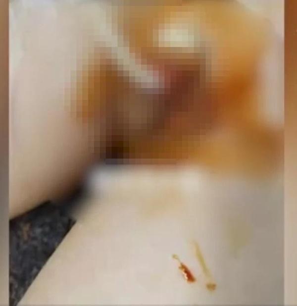 Bé trai nghi bị cô giáo cắt bộ phận sinh dục: Phụ huynh tố lên MXH, nhà trường dọa kiện giữ uy tín-3