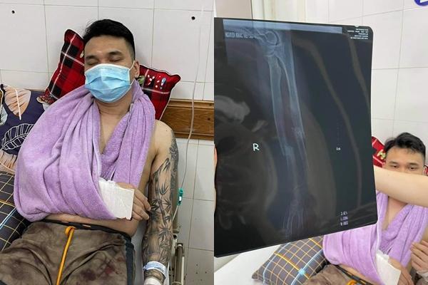 Tình hình sức khỏe Khắc Việt sau ca phẫu thuật-5