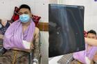 Khắc Việt gặp chấn thương nghiêm trọng, nhập viện cấp cứu