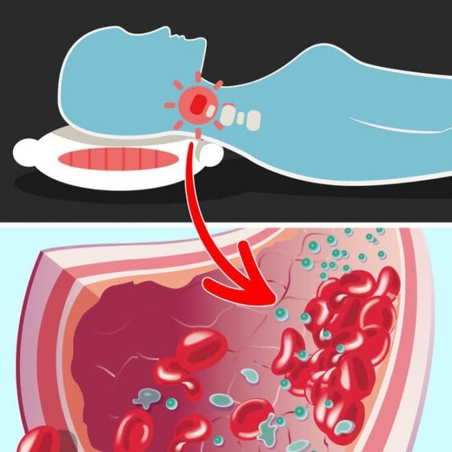 Đây là những điều kỳ diệu xảy ra với làn da của bạn nếu ngủ mà không có gối-3