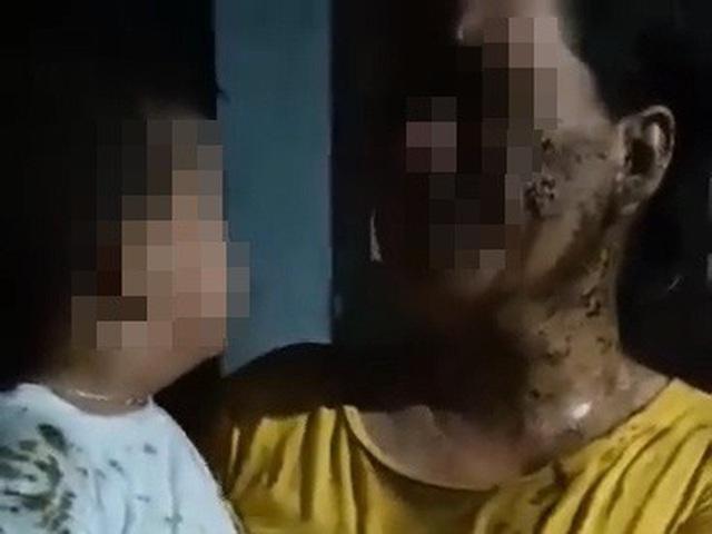 Phẫn nộ: Bé 2 tuổi bị hàng xóm đổ phân lên đầu vì mẹ vay nợ chưa trả-2