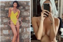Cháy nắng cũng phải 'kinh' như sao Việt: Minh Triệu hằn bikini - Bảo Anh lưng rát đỏ