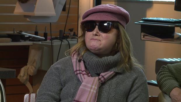 Tự tử bất thành, cô gái phá hủy khuôn mặt đáng sợ, kỳ tích sau đó thực sự vỡ òa-10