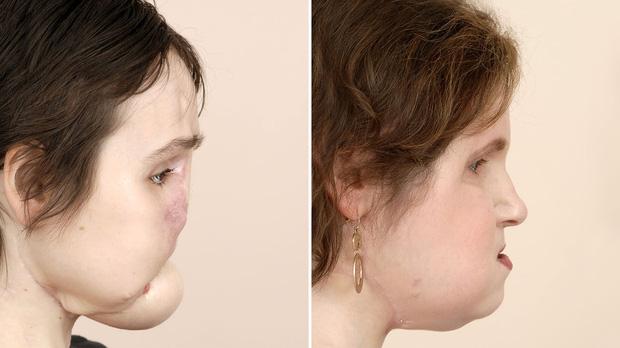 Tự tử bất thành, cô gái phá hủy khuôn mặt đáng sợ, kỳ tích sau đó thực sự vỡ òa-9