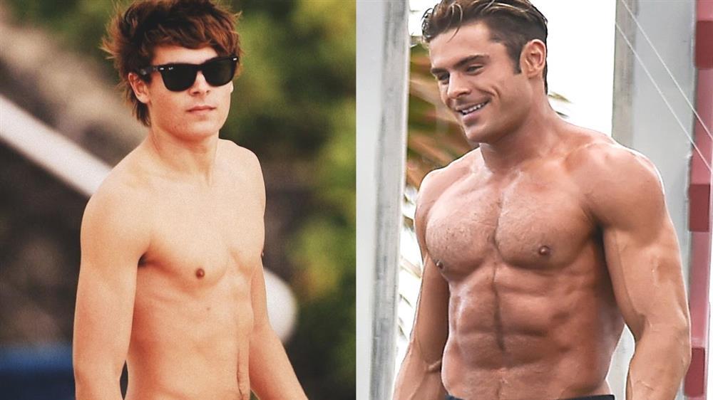 Sốc: Zac Efron biến dạng xương mặt, lại là kết quả dao kéo quá đà?-3