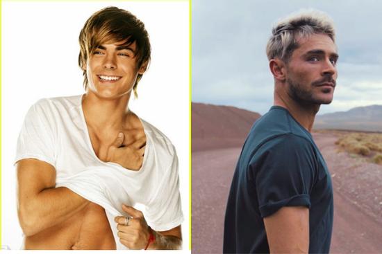 Sốc: Zac Efron biến dạng xương mặt, lại là kết quả 'dao kéo' quá đà?