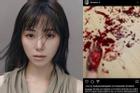 Mina (AOA) đăng ảnh bàn tay be bét máu, nghi cố tự tử