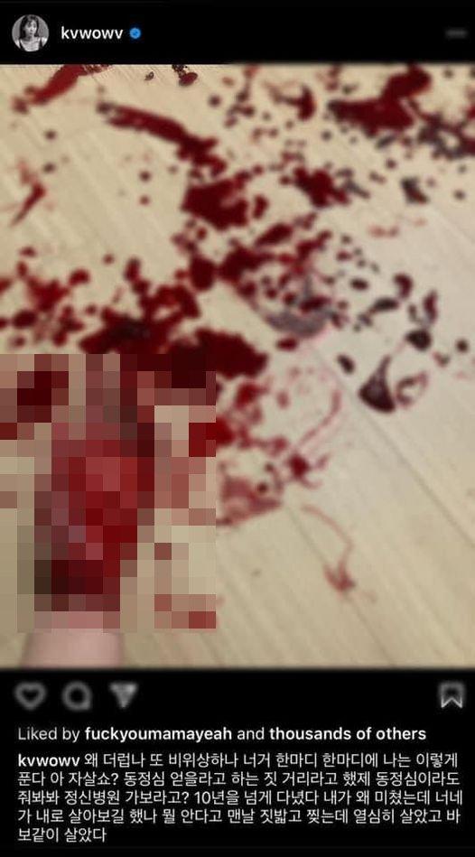 Mina (AOA) đăng ảnh bàn tay be bét máu, nghi cố tự tử-1