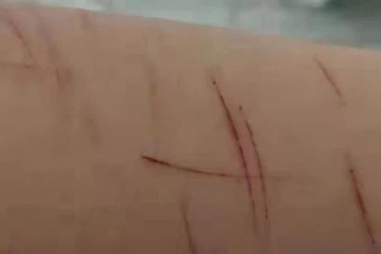 Nam sinh 16 tuổi bị hắt nước tiểu, án dành cho kẻ bắt nạt gây phẫn nộ