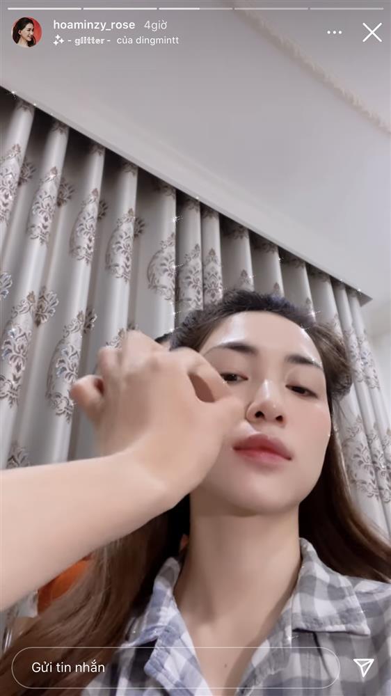 Hòa Minzy muốn trầm cảm vì da dẻ bong tróc thành từng mảng-5