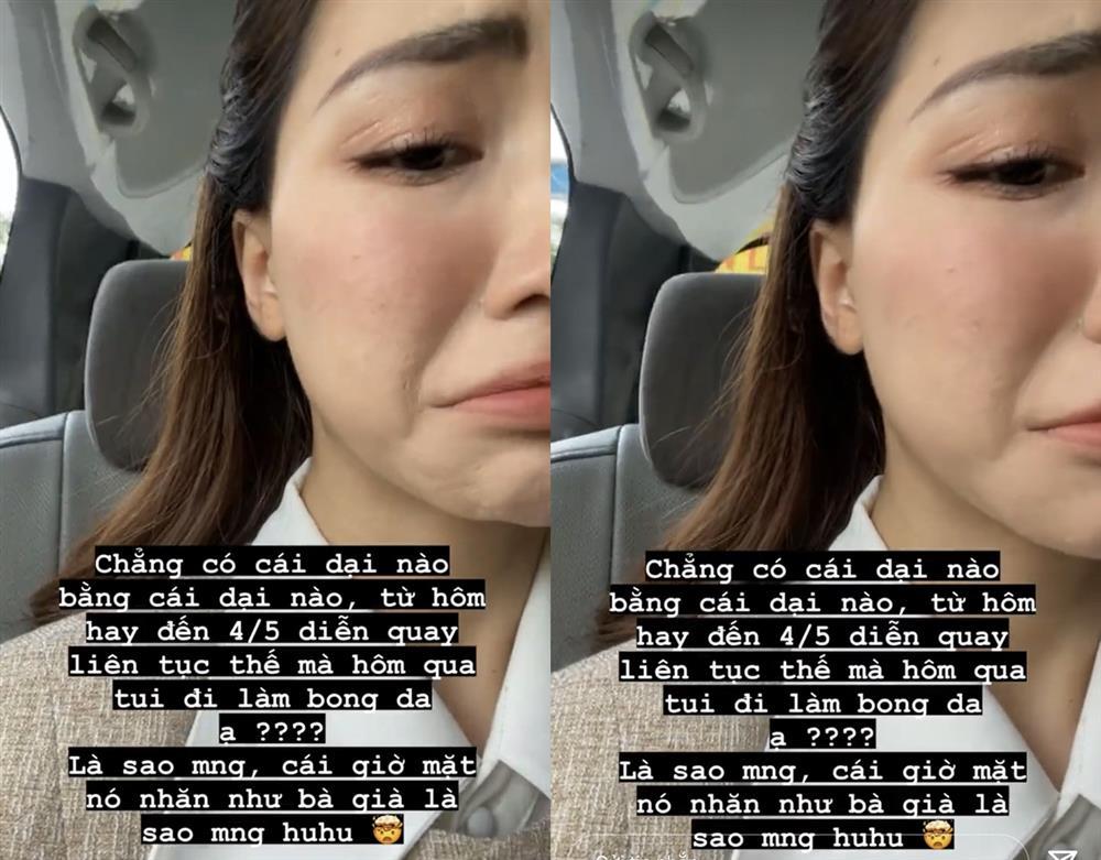 Hòa Minzy muốn trầm cảm vì da dẻ bong tróc thành từng mảng-6