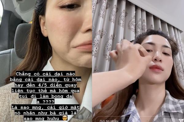 Đằng sau làn da hoàn hảo của idol Hàn là sự thật khiến dân tình vỡ mộng-12