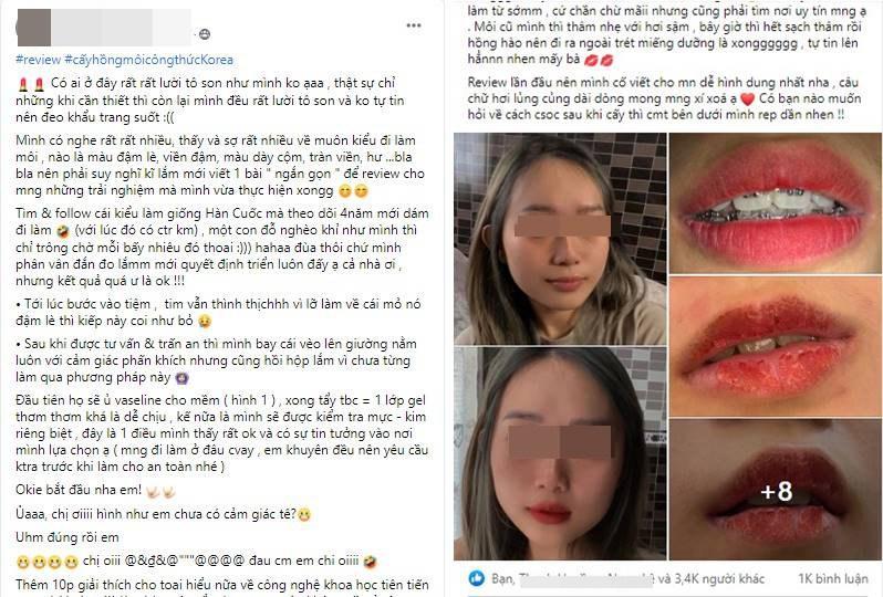 Hồi hộp xem review cấy hồng môi khử thâm, chuyên gia nói gì về phương pháp này?-1