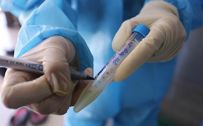 Hà Nam: Truy vết nhanh 19 F1, 6 F2 liên quan tới ca mắc Covid-19 mới-1