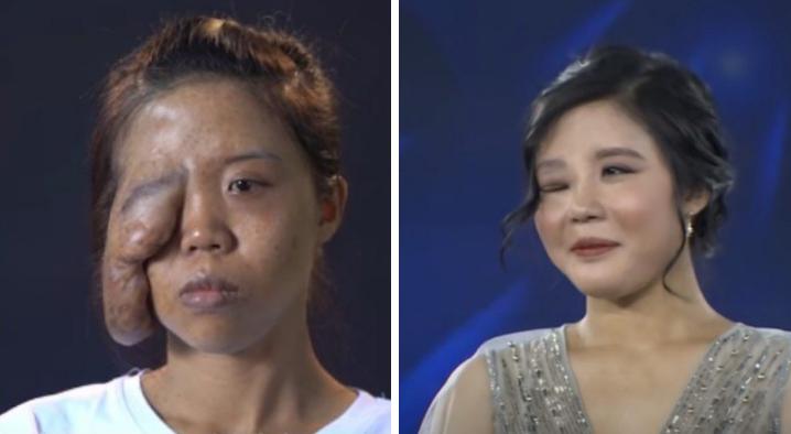 Những người phụ nữ mang mặt quỷ hóa thiên thần nhờ phẫu thuật thẩm mỹ-2