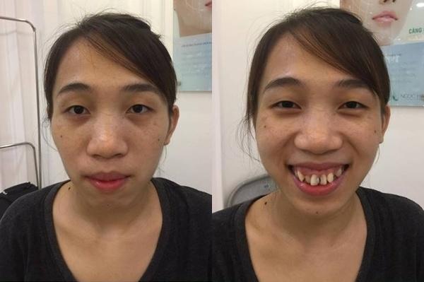 Những người phụ nữ mang mặt quỷ hóa thiên thần nhờ phẫu thuật thẩm mỹ-11