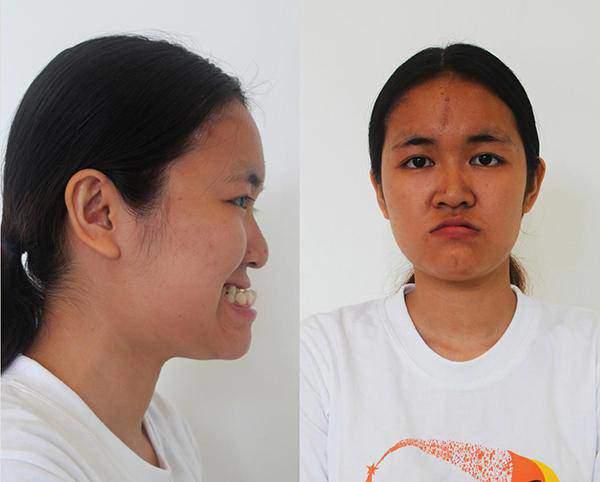 Những người phụ nữ mang mặt quỷ hóa thiên thần nhờ phẫu thuật thẩm mỹ-13