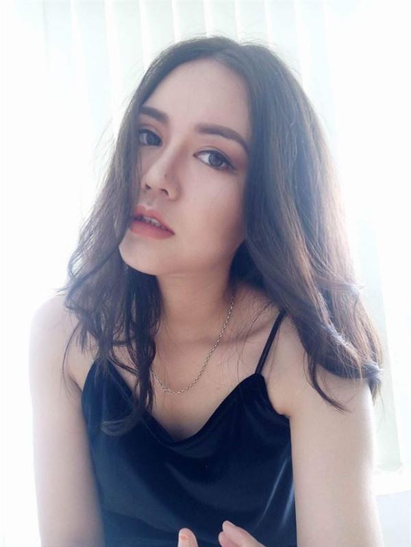 Những người phụ nữ mang mặt quỷ hóa thiên thần nhờ phẫu thuật thẩm mỹ-15