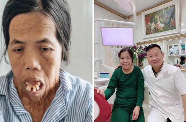 Những người phụ nữ mang mặt quỷ hóa thiên thần nhờ phẫu thuật thẩm mỹ-3