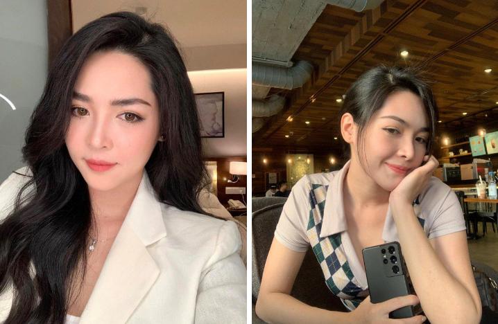 Những người phụ nữ mang mặt quỷ hóa thiên thần nhờ phẫu thuật thẩm mỹ-4