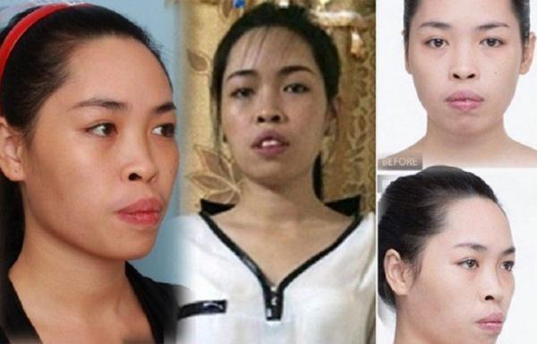 Những người phụ nữ mang mặt quỷ hóa thiên thần nhờ phẫu thuật thẩm mỹ-6