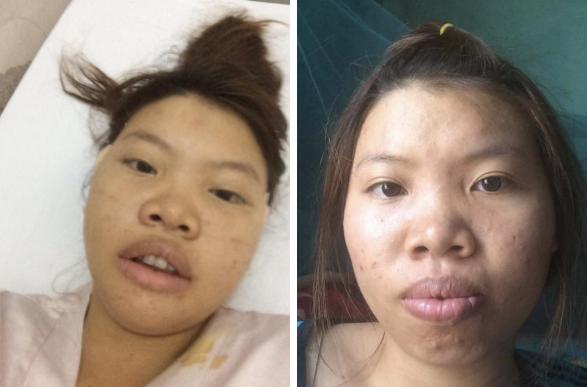 Những người phụ nữ mang mặt quỷ hóa thiên thần nhờ phẫu thuật thẩm mỹ-8