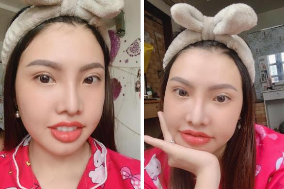 Những người phụ nữ mang mặt quỷ hóa thiên thần nhờ phẫu thuật thẩm mỹ-9