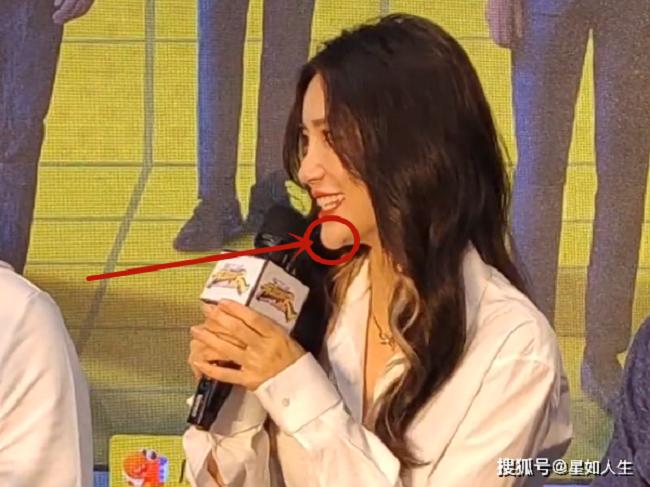 Gương mặt Angela Baby ngày càng khác lạ, di chứng thẩm mỹ lộ rõ?-1