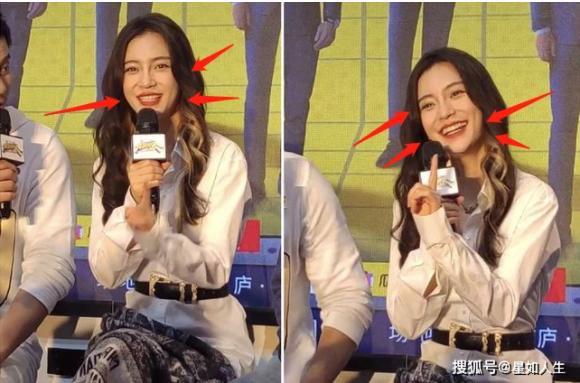 Gương mặt Angela Baby ngày càng khác lạ, di chứng thẩm mỹ lộ rõ?-2