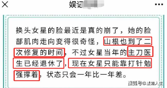 Gương mặt Angela Baby ngày càng khác lạ, di chứng thẩm mỹ lộ rõ?-4