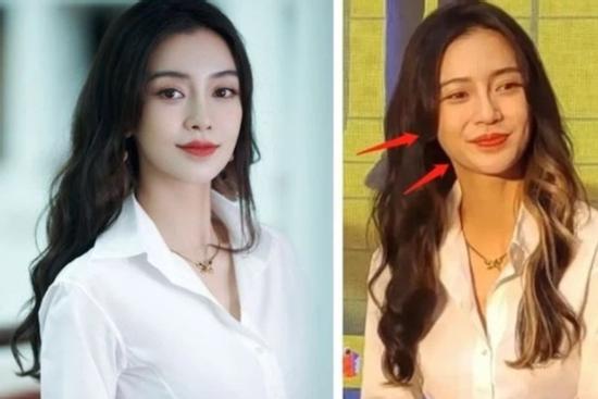 Gương mặt Angela Baby ngày càng khác lạ, di chứng thẩm mỹ lộ rõ?