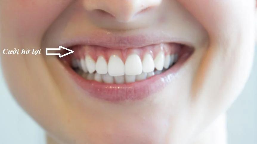 Phụ nữ xinh đẹp đến mấy nhưng có 7 nét tướng này lận đận tình duyên, dễ hai lần đò-1