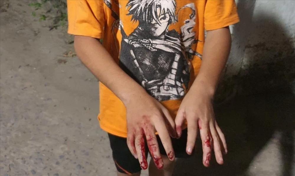 Nguyên nhân thực sự vụ bố lấy gậy tre đánh con tóe máu ở TP HCM-1