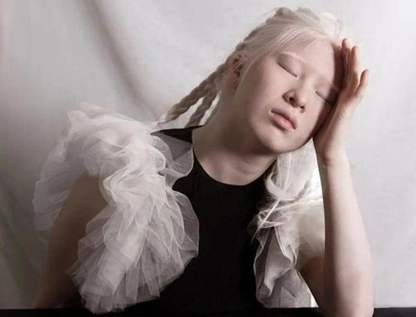 Cô bé bị bố mẹ bỏ rơi thành người mẫu nổi tiếng-2