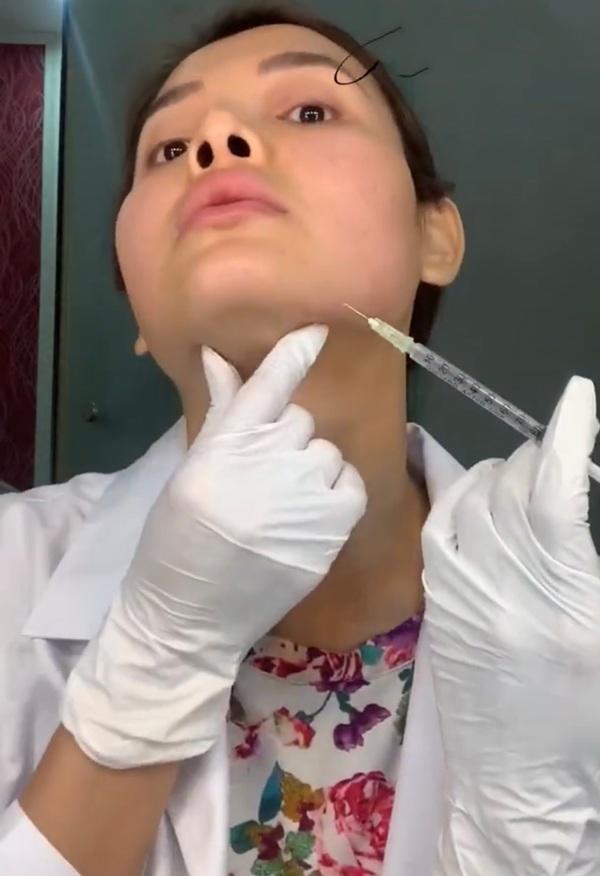 Huyền Baby - Phương Trinh Jolie: Công khai tiêm filler nhìn mà nổi da gà-4