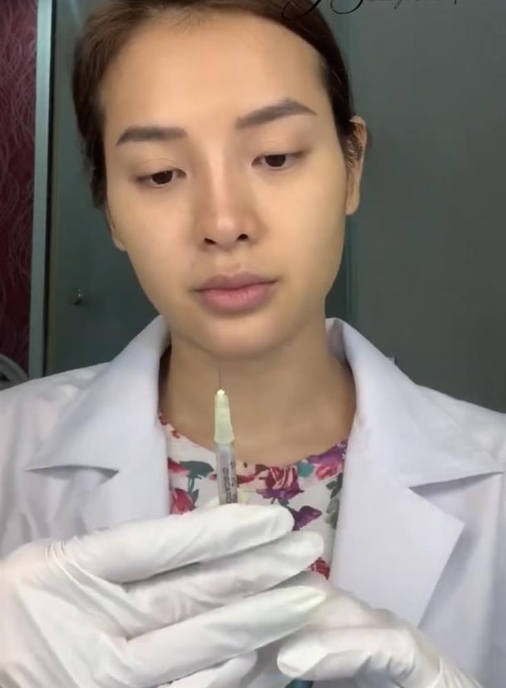 Huyền Baby - Phương Trinh Jolie: 2 mỹ nhân công khai tiêm filler mặt nhìn nổi da gà-5