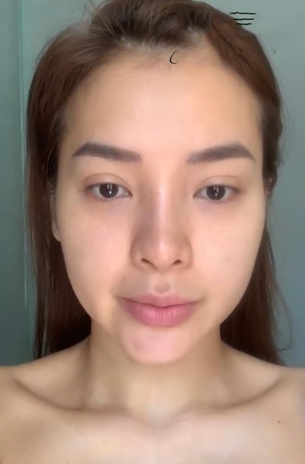 Huyền Baby - Phương Trinh Jolie: 2 mỹ nhân công khai tiêm filler mặt nhìn nổi da gà-6