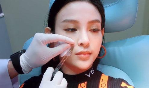 Huyền Baby - Phương Trinh Jolie: 2 mỹ nhân công khai tiêm filler mặt nhìn nổi da gà-9