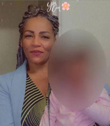 Người phụ nữ Anh tử vong sau ca phẫu thuật nâng vòng ba-2