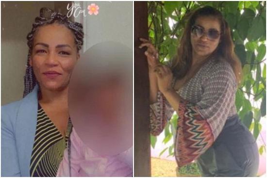 Người phụ nữ Anh tử vong sau ca phẫu thuật nâng vòng ba