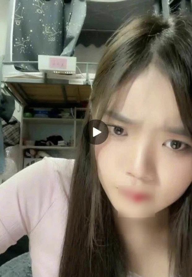 Đang livestream, nữ idol nhăn nhó rồi bất ngờ... hộc máu miệng trước sự bàng hoàng của netizen-2