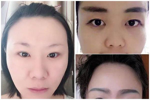 Mốt làm mặt hình chữ V như Angelababy, Dương Mịch là sai lầm?-4